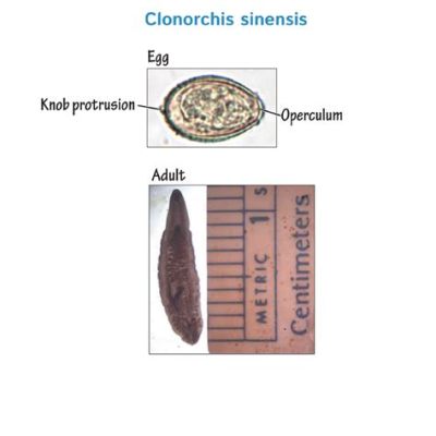  Clonorchis Sinensis: A Tiny Trematode with a Taste for Fish (and Humans!)