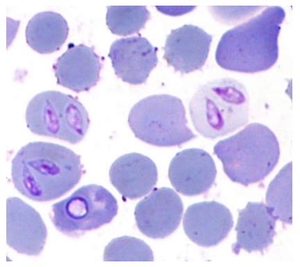  Yellow-Eyed Babesia? A Blood-Sucking Parasite That Lurks Within!